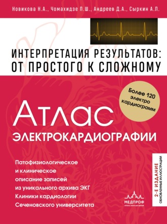 Атлас электрокардиографии. Интерпретация результатов: от простого к сложному. 2-е издание. Петр Чомахидзе