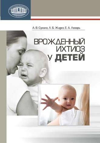 Врожденный ихтиоз у детей. 