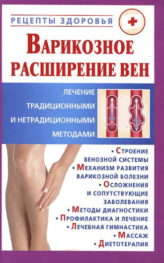 Виктор Горбунов. Варикозное расширение вен. Лечение традиционными и нетрадиционными методами